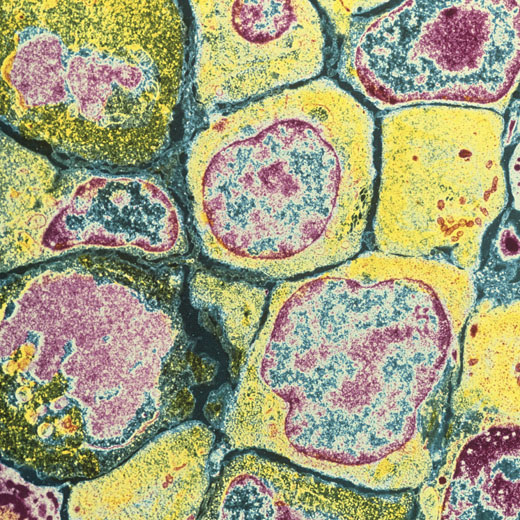 Scanning electron microscope image of bone marrow stem cells in the process of developing into various types of blood cells. CREDIT: Sterling Publishing