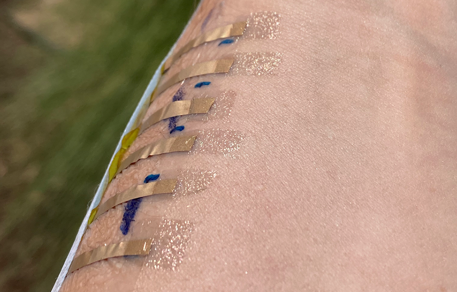 A closeup of a forearm with blue ink lines perpendicular to adhesive sensors with a wire attaching them