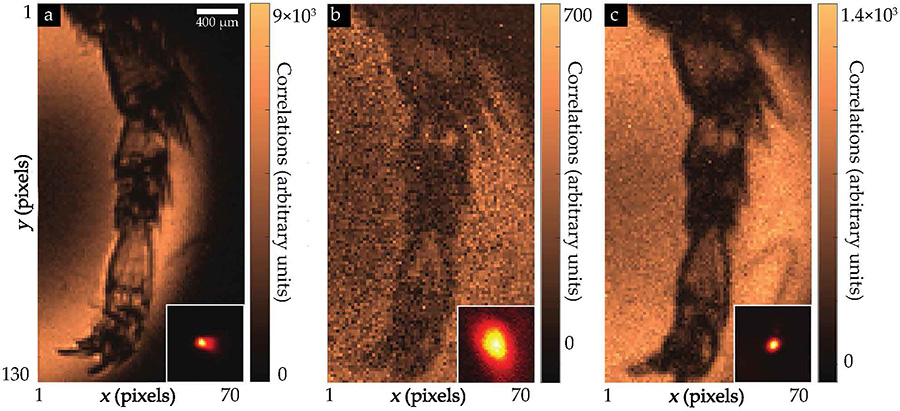 Three images of a bee’s leg. The image corrected via quantum adaptive optics is noticeably less blurry than the uncorrected image.