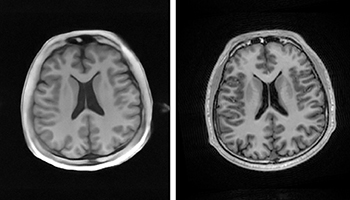 Ultralow-field MRI machine costs less than a car
