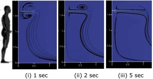 FIG. 7. Air velocity during continuous talking with streamlines.
