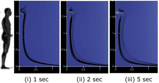 FIG. 9. Air velocity during breathing with streamlines.