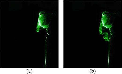 FIG. 13. Escape of exhalation jets from a surgical mask with a face shield at (a) t = 2 s and (b) t = 4 s during breathing for E:I = 1:2.