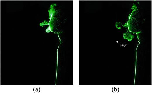 FIG. 14. Leakage of respiratory jets from a two-layered cotton mask at (a) t = 2 s and (b) t = 4 s during breathing for E:I = 1:1.