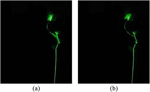 FIG. 17. Spraying of respiratory droplets from a five-layered anti-pollution face mask at (a) t = 2 s and (b) t = 3 s during breathing for E:I = 1:2.
