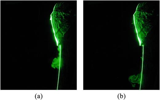 FIG. 8. Leakage of respiratory jets from a two-layered triangle mask at (a) t = 2 s and (b) t = 4 s during breathing for E:I = 1:1.