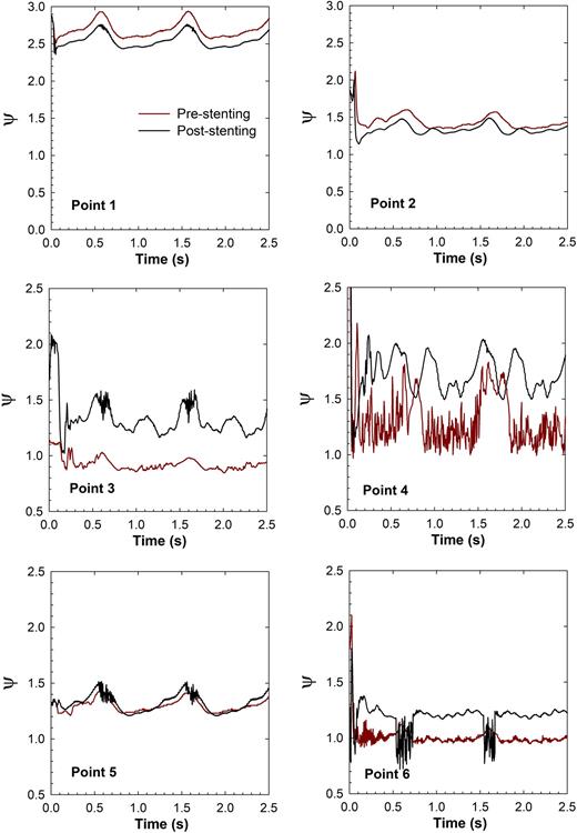 FIG. 10. Time series trace of the local viscosity index (ψ) in pre-stenting (case 1) and post-stenting (case 2) conditions along six centerline points along the domain.