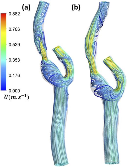 FIG. 5. Streamlines of time-averaged velocity of (a) case 1 and (b) case 2.