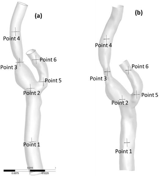 FIG. 7. Locations taken on (a) pre-stent and (b) post-stent centerlines to monitor turbulence in time and frequency domains.
