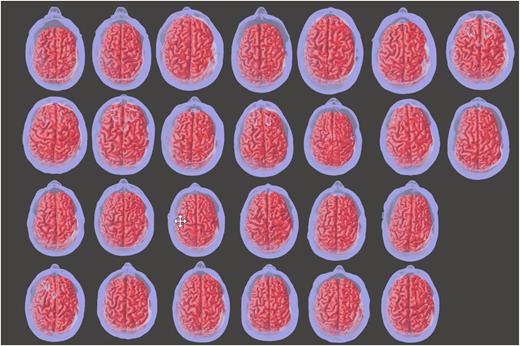 FIG. 2. Anatomically accurate head models developed from MRIs of 26 individuals with mTBI, ordered from left to right then top to bottom, shown in Meshmixer.
