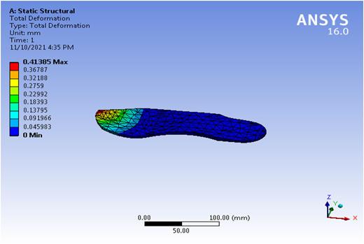 A deformation of 0.4385 mm is observed on heel when a load of 20 kg (196 N) is applied at toe.