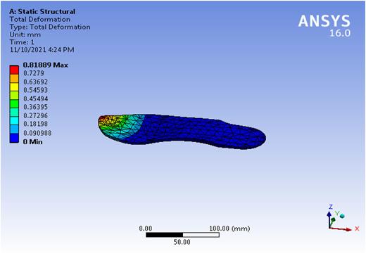 A deformation of 0.8188 mm is observed on heel when a load of 40 kg (392 N) is applied at toe.