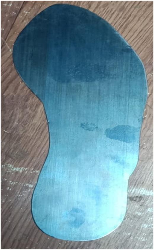 A carbon fiber footplate manufactured according to 3D printed template.