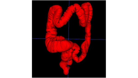 A computational model of the human colon for use in medical robotics ...