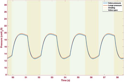 Valve and lung pressure (cmH2O) vs time (s).