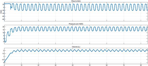 Flow (l/min), pressure (cmH2O), and volume (l) vs simulation time (s).