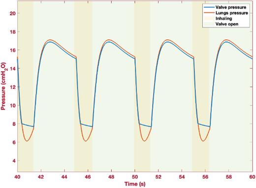 Valve and lung pressure (cmH2O) vs time (s).
