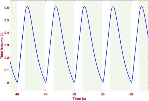 Tidal volume (l) vs time (s).