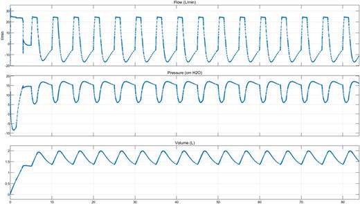 Flow (l/min), pressure (cmH2O), and volume (l) vs simulation time (s).