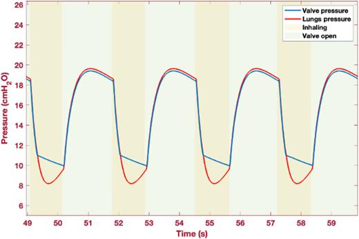 Valve and lung pressure (cmH2O) vs time (s).