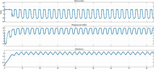 Flow (l/min), pressure (cmH2O), and volume (l) vs simulation time (s).