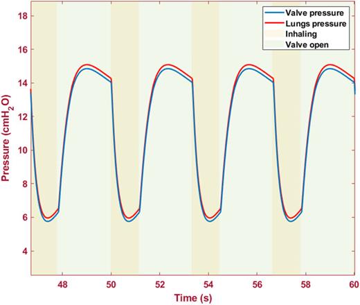 Valve and lung pressure (cmH2O) vs time (s).