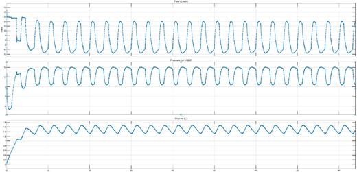 Flow (l/min), pressure (cmH2O), and volume (l) vs simulation time (s).