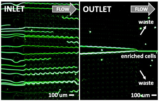 Deterministic separation of cancer cells from blood at 10 mL/min | AIP ...