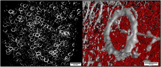 FIG. 2. X-Ray tomography showing toroidal formations in PDMS with 1% CIP (mass).