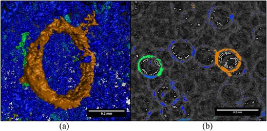 FIG. 4. X-Ray tomography showing a) toroidal formations with 2% wt CIP, b) with contigation.
