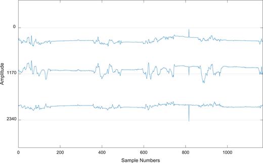 FIG. 10. Acceleration spectrum.