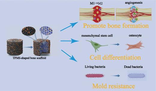 Research progress of 3D-printed anti-infective bone tissue engineering ...