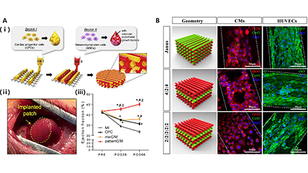 3D bioprinting of stem cell-laden cardiac patch: A promising ...