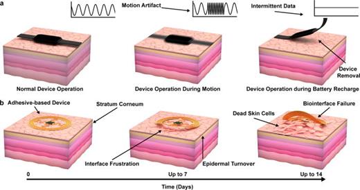 FIG. 4. Limitations of current wearable devices for biosensing applications. (a) Illustration showing conventional wrist worn wearable systems during operation. (b) Illustration of wearables utilizing adhesive interfaces during operation with key limitations in epidermal turnover.