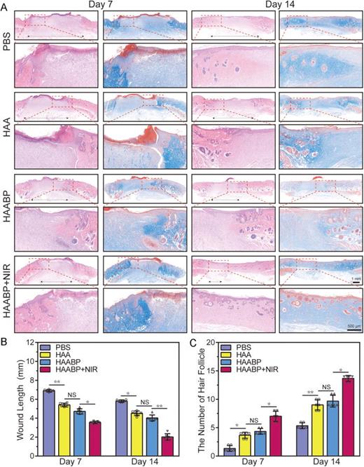 FIG. 5. Histological analysis in vivo. (a) HE and Masson staining in control, HAA, HAABP, and HAABP–NIR groups on days 7 and 14. (b) Wound length was measured in each group's HE staining on days 7 and 14. (c) The number of newborn hair follicles in the repaired area in different groups on days 7 and 14.