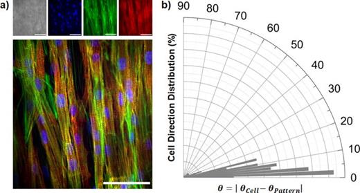 Engineering anisotropic cardiac tissue on micro-molded gelatin. (a) Fluorescence images of anisotropic NRVMs tissue (scale bar 20 μm). The cells are stained with DAPI (blue), F-actin (green), and a-actinin (red). (b) Distribution of the cellular nuclear orientations on MTFs. The orientation distribution is normalized to the pattern direction (N = 130 nuclei from 3 MTFs) (average angle of the distribution,     θ  mean = 8.89 ° ± 0.75 °).