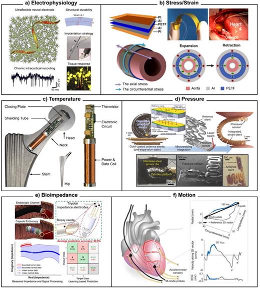 Implantable sensor examples for biophysical parameters. (a) Electrophysiology: flexible neural probes record extracellular neuronal potentials with minimal tissue disruption. The figure shows the typical sensor concept, readout, and design considerations. Reproduced with permission from He et al., iScience 23, 101387 (2020). Copyright 2020 Elsevier.67 (b) Stress/strain: a blood pressure sensor based on monitoring arterial wall strain using a piezoelectric cuff wrapped around the artery. The figure illustrates structure, function, and implantation. Reproduced with permission from Cheng et al., Nano Energy 22, 453–460 (2016). Copyright 2016 Elsevier.63 (c) Temperature: this sensor is intended to monitor hip implant failure from friction-induced heating. The figure shows its placement and various sensor package components. Reproduced with permission from PLoS One 7, e43489 (2012). Copyright 2012 Authors, licensed under a Creative Commons (CC BY) license.56 (d) Pressure: another blood pressure sensor, with a stent-mounted package directly monitoring liquid pressure. The figure illustrates the sensing principle as well as various schematics and views of package components. Reproduced with permission from Chen et al., Adv. Sci. 5, 1700560 (2018). Copyright 2018 Authors, licensed under a Creative Commons (CC BY) license.64 (e) Bioimpedance: a sensor designed for a GI capsule endoscopy (or traditional endoscope) to detect colorectal tumor tissue. The figure illustrates mounting concepts as well as sensor performance. Reproduced with permission from Nguyen et al., ACS Sens. 7, 632–640 (2022). Copyright 2022 ACS.72 (f) Motion: MEMS accelerometers mounted on the heart to monitor muscle motion. The figure illustrates sensor placement (alongside additional probes for comparison), and also compares sensor output to traditional ECG. Reproduced with permission from Grymyr et al., Interact. Cardiovasc. Thorac. Surg. 21, 573–582 (2015). Copyright 2015 OUP.57