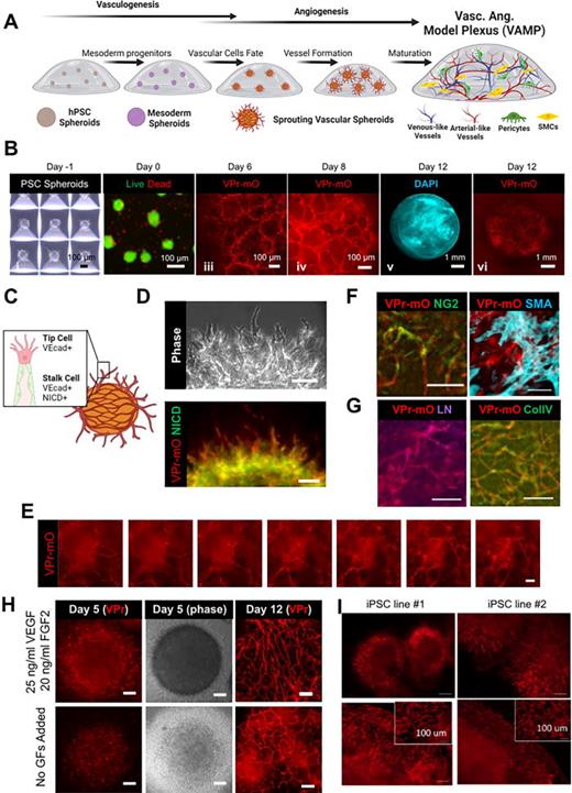 VAMPs demonstrate vasculogenic, angiogenic, and vessel maturation events. VAMPs can be biased toward angiogenic events when VEGF and FGF2 are added into the medium. (a) Schematic showing the development of the VAMP model. hPSC spheroids are encapsulated into a hydrogel support and differentiated into ECs, pericytes, and smooth muscle cells that self-assemble into vascular networks via vasculogenic and angiogenic behaviors. (b) (i) Phase image of hPSC spheroids generated in an Aggrewell dish on day 1. Scale bar = 100 μm. (ii) Image of live (calcein AM) and dead (ethidium homodimer-1) cells after spheroid encapsulated into a fibrin hydrogel on day 0. Scale bars = 200 μm. (iii) Image of ECs visualized by VPr-mOrange reporter within and sprouting from spheroids within a fibrin hydrogel on day 6. Scale bar = 100 μm. (iv) Image of EC networks visualized by VPr-mOrange reporter assembled within a fibrin hydrogel on day 8. Scale bar = 100 μm. (v) Low-power image of VAMP construct stained with DAPI on day 12. Scale bar = 1 mm. (vi) Low-power image of VAMP construct of ECs visualized by VPr-mOrange reporter on day 12. Scale bar = 1 mm. (c) Schematic of tip and stalk cell phenotypes sprouting from vascular spheroids encapsulated in a hydrogel. (d) Image of cells sprouting from spheroids encapsulated in a fibrin gel on day 5. ECs were visualized with the VE-cadherin-promotor-mOrange reporter (VPr-mO) and immunostained for the NOTCH1 intracellular domain (NICD). Scale bars = 100 μm. (e) Z-stack images through a VAMP construct on day 12 (∼800 μm thick). Vascular structures were visualized with the VPr-mOrange reporter. Scale bar = 100 μm. See the supplementary material, Video 4. (f) Immunofluorescence of VAMPs at day 12. Vascular structures were visualized with the VPr-mOrange reporter and stained for mural cells: pericytes (NG2) and SMCs [smooth muscle actin (SMA)]. Scale bars = 100 μm. (g) Immunofluorescence of VAMPs at day 12. Vascular structures were visualized with the VPr-mOrange reporter and stained for basement membrane protein deposition: collagen IV (Col IV) and laminin (LN). Scale bars = 50 μm. (h) Images of 3D vascular models on day 5 and day 12. Models were generated from 3D differentiation protocols by adding 25 ng/ml VEGF and 20 ng/ml FGF2 into the medium on day 2 compared to no growth factors added. ECs were visualized using with the VPr-mOrange reporter. Scale bars = 100 μm. (i) Images of VAMP models derived from additional iPSC lines. Images taken on day 6 (top images) demonstrate sprouting behavior and images taken on day 14 (bottom images) demonstrate vascular network formation. Scale bars = 200 μm. Inset scale bar = 100 μm.