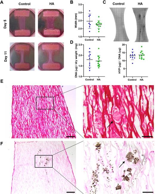 A tissue-engineered model of the atherosclerotic plaque cap: Toward ...
