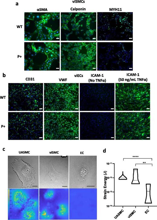 Characterization of viSMCs and viECs modified to activate PCSK9 expression. (a) Representative immunofluorescent images of WT and P+ viSMCs expressing markers of mature smooth muscle: αSMA, calponin, and MYH11. αSMA scale bars = 50 μm. Calponin and MYH11 scale bars = 100 μm. (b) Representative immunofluorescent images of WT and P+ viECs expressing markers of mature and functional endothelial cells: CD31, vWF, and ICAM-1 in the presence or absence of TNFα. Scale bars =100 μm. (c) Representative bright field images UASMC, WT viSMC, and EC on 7 kPa PAA gels (top, scale bars indicate 20 μm) and the associated strain energy visualized on each cell (bottom) by traction force microscopy. (d) Violin plot of strain energy calculated on each cell type, center dashed line indicating median value, N = 32 per cell type from four independent experiments. One-way ANOVA with Tukey post hoc test, *P < 0.05 **P < 0.005, ***P < 0.0005, and **** P < 0.0001.