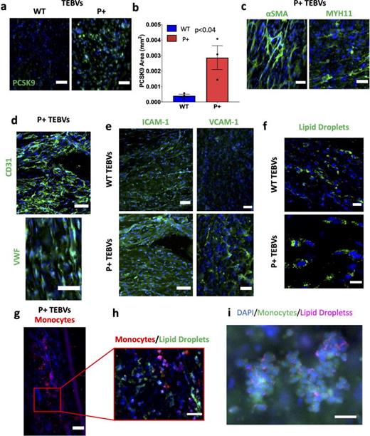 Characterization of TEBVs fabricated with cells modified to activate PCSK9 expression. (a) Representative en face immunofluorescent images of PCSK9 expression in WT and P+ TEBVs. Scale bars = 100 μm. (b) Quantification of PCSK9 positive area from (a). Results from WTC11 donor (WT n = 3, P+ n = 3). Statistical analysis was performed using a Student's t-test. (c) Representative immunofluorescent images of P+ TEBVs expressing mature smooth muscle markers, αSMA and MYH11. Scale bars = 100 μm. (d) Representative immunofluorescent images of P+ TEBVs expressing mature endothelial cell markers, CD31 and vWF. Scale bars = 100 μm. (e) Representative immunofluorescent images of WT and P+ TEBVs expressing adhesion molecules ICAM-1 and VCAM-1 after exposure to 50 ng/ml TNF-α and 60 μg/ml eLDL. Scale bars = 100 μm. (f) Representative immunofluorescent images of lipid accumulation in the smooth muscle cells of the WT and P+ TEBVs after exposure to 60 μg/ml eLDL. Scale bar = 25 μm. (g) Representative immunofluorescent images of monocyte adhesion in P+ TEBVs after exposure to 50 ng/ml TNF-α and 60 μg/ml eLDL. Scale bar = 100 μm. (h) Magnification of specific area in the image from (g) showing monocyte adhesion and lipid accumulation in smooth muscle cells and monocytes. Scale bar = 50 μm. (i) Lipid droplets (purple) shown around monocytes (green) in TEBV. Scale bar = 50 μm.