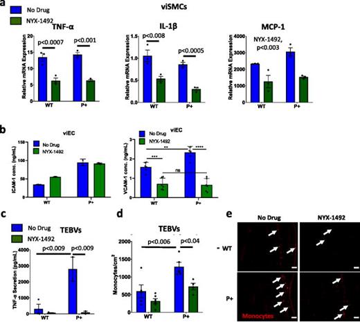 Small molecule PSCK9 inhibitors reduce inflammation and monocyte adhesion in P+ TEBVs. (a) mRNA expression of inflammatory cytokines, TNF-α, IL-1β, and MCP-1 in WTC11 WT and P+ viSMCs after 48 h of exposure to 50 ng/ml TNF-α and 10 μg/ml eLDL, with or without 8 μM NYX-1492. Results from WTC11 donor (WT No Drug n = 3, WT NYX-1492 n = 3, P+ No Drug n = 3, and P+ NYX-1492 n = 3). Statistical analysis was performed using a two-way ANOVA with post-hoc Tukey test for multiple comparisons for each cytokine. (b) ICAM-1 and VCAM-1 secretion from DU11 WT and P+ viECs after 48 h of exposure to 50 ng/ml TNF-α and 10 μg/ml eLDL, with or without 8 μM NYX-1492. n = 6 from two experiments, experiments were repeated twice, one-way ANOVA with post-hoc Tukey test, *p < 0.05, **p < 0.01, ***p < 0.001, or ****p < 0.0001. (c) TNF-α secretion from WTC11 WT and P+ non-branched TEBVs after exposure to 50 ng/ml TNF-α and 60 μg/ml eLDL for 96 h, with or without 8 μM NYX-1492. The medium was replaced at around 84-h timepoint to remove exogenous TNFα 12 h prior to collection for analysis. Results from WTC11 donor (WT No Drug n = 3, WT NYX-1492 n = 3, P+ No Drug n = 2, and P+ NYX-1492 n = 2). Statistical analysis was performed using a two-way ANOVA with post-hoc Tukey test for multiple comparisons for each cytokine. (d) Quantification of U937 monocyte adhesion in (e). Results from WTC11 donor (WT No Drug n = 5, WT NYX-1492 n = 6, P+ No Drug n = 5, and P+ NYX-1492 n = 4). Statistical analysis was performed using a two-way ANOVA with post-hoc Tukey test for multiple comparisons for each cytokine. (e) Representative immunofluorescent images of U937 monocyte adhesion in WTC11 WT and P+ non-branched TEBVs after exposure to 50 ng/ml TNF-α and 60 μg/ml eLDL for 96 h, with or without 8 μM NYX-1492. Arrows indicate areas with adhered monocytes. Scale bars = 100 μm.
