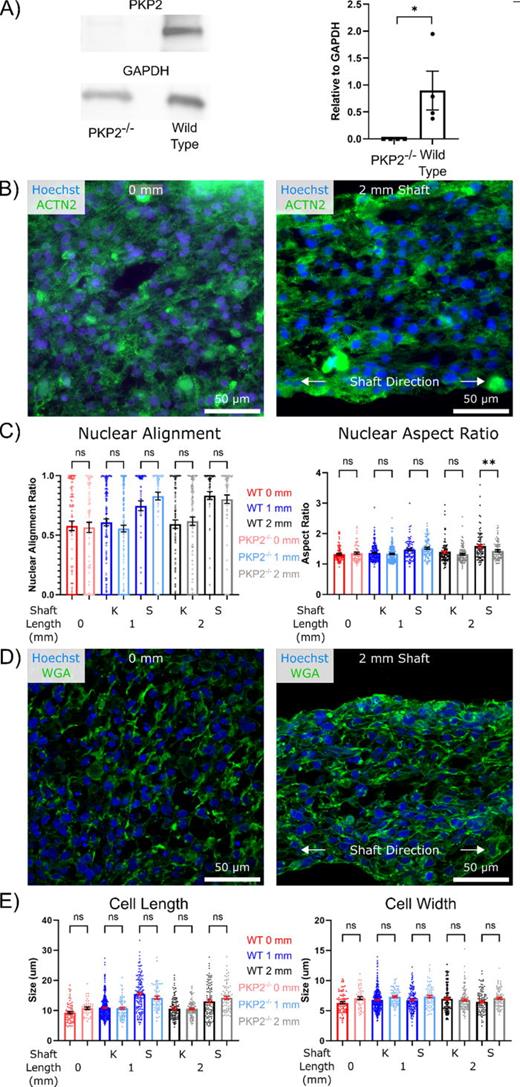Loss of PKP2 does not inhibit prestress regulation of cell morphology (a) Representative western blot for plakophilin-2 in wild type and PKP2−/− iPSC, and the resulting quantification from four blots. (b) Representative images of nuclei (Hoechst/blue) and sarcomeric α–actinin (green) of 0 and 2 mm PKP2−/− μHM at μD15. (c) Quantification of the effects of tissue geometry on nuclear alignment and nuclear aspect ratio at μD15 on PKP2−/− μHM in comparison to wild type tissues. (n > 70 nuclei from 6 to 8 μHM per size). (d) Representative images of nuclei (Hoechst/blue) and cell membrane (wheat germ agglutinin/green) of 0 and 2 mm PKP2−/− μHM at μD15. (e) Quantification of the effects of tissue geometry on cell length and width at μD15 on PKP2−/− μHM in comparison to wild type tissues. (n >100 cells from 6 to 8 μHM, *: p < 0.05, **: p < 0.005, ***: p < 0.0005, error bars: SEM).