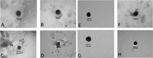 TEM images of CQD_1L (A) and (B), CQD_7L (C) and (D), CQD_7LD (E) and (F), and CQDs_7LDD (G) and (H) at different magnifications.