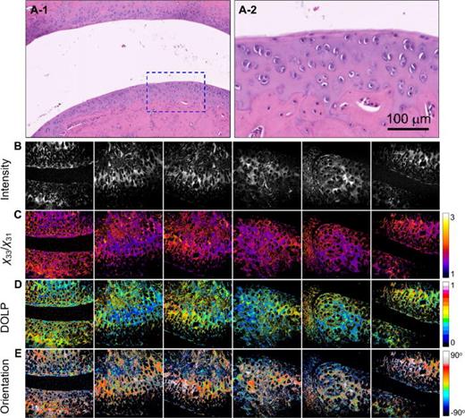 Images of RA-C tissue: (a-1) and (a-2) H&E-stained images, where (a-2) shows a magnified view of the region indicated in (a-1). (b)–(e) are the SHG intensity, χ33/χ31, DOLP, and planar orientation of the RA-C tissues, respectively. The color scale shows the values of each parameter. Image size = 400 × 400 μm2. Images (b)–(e) are representative and were selected from the samples used (n = 5).