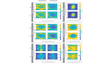 Toward assessment of rupture risk predictors in abdominal aortic ...