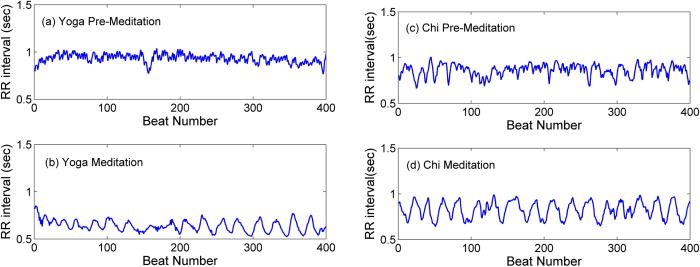 Visibility graph analysis on heartbeat dynamics of meditation training ...