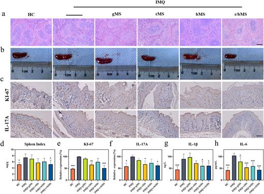 Nanozyme microspheres with structural color-coding labels for ...