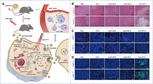 (a) Schematic illustration depicting the interaction between virus-like Au NV-MTO particles and cancer cells. (b) Hematoxylin and eosin (H&E) staining of MC38 tumor tissue excised on day 12 post-initial treatment. Scale bar: 200 μm. (c) Ki67 staining and (d) TUNEL assay of MC38 tumor-bearing mice on day 12 following the initial treatment. Scale bar: 40 μm. Reproduced with permission from Wang et al., ACS Nano 18, 28038–28051 (2024). Copyright 2024 American Chemical Society.