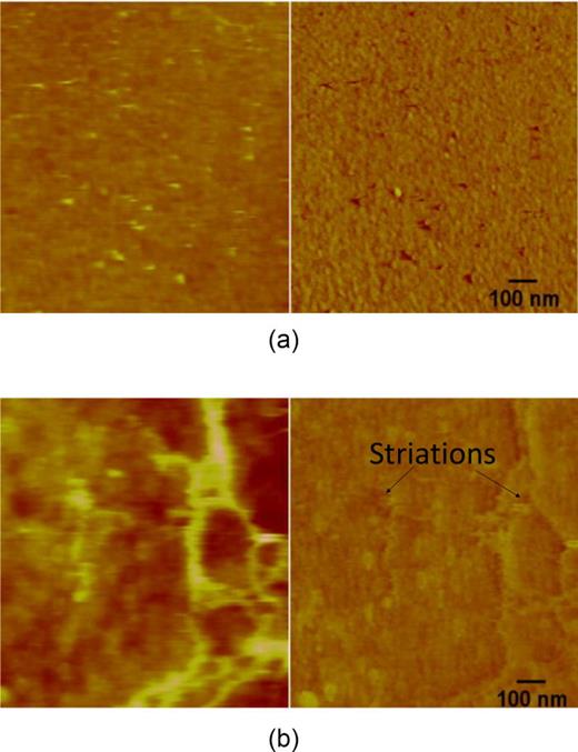 FIG. 7. AFM image pair (z height and phase (right)) for (a) endothelial and (b) glioblastoma cells.